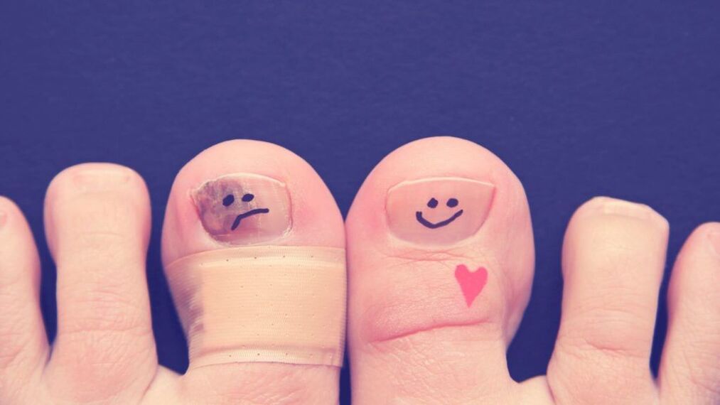 Why are nail fungus dangerous
