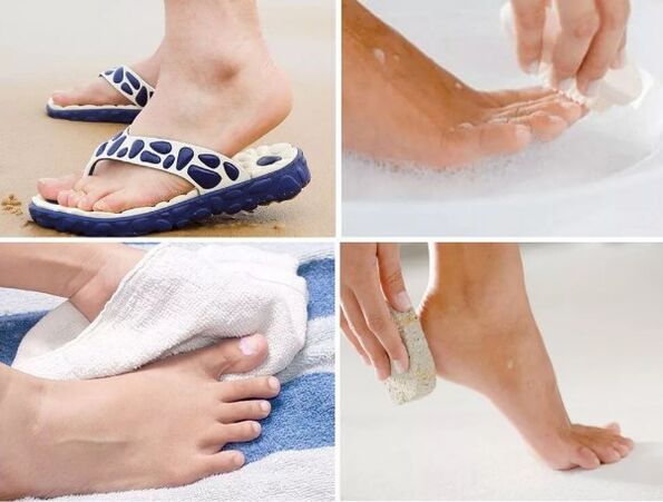 Fungal prevention