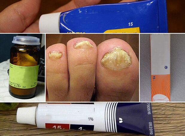General principles for fungi treatment