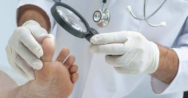 foot exam for fungal infections